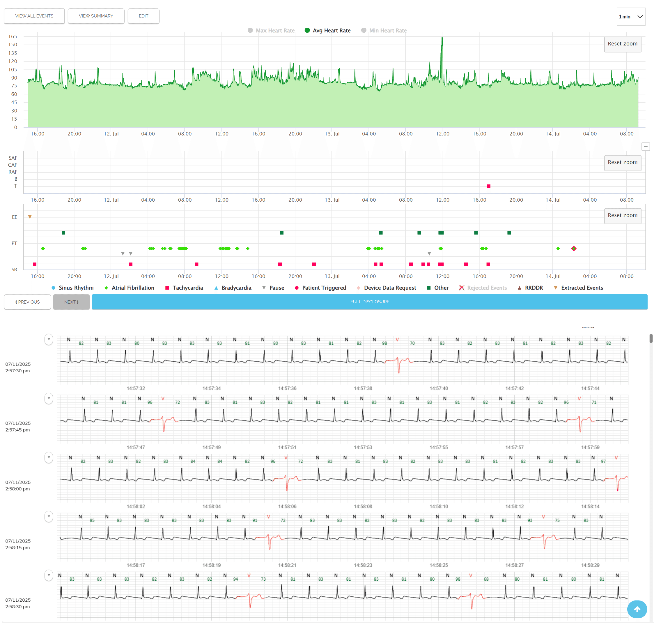 Full disclosure view — heart rate trend, event markers, and continuous ECG strips